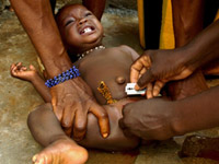 Historie ženské obřízky